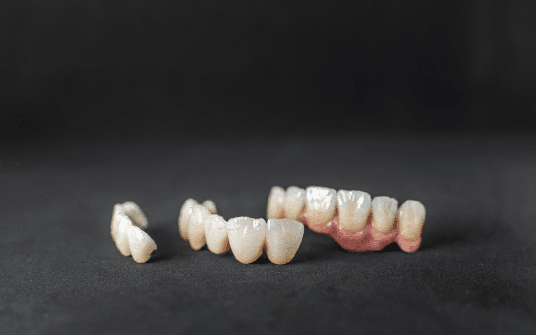 Top Tips for Maintaining Your Custom Dental Crown for Long-Lasting Durability