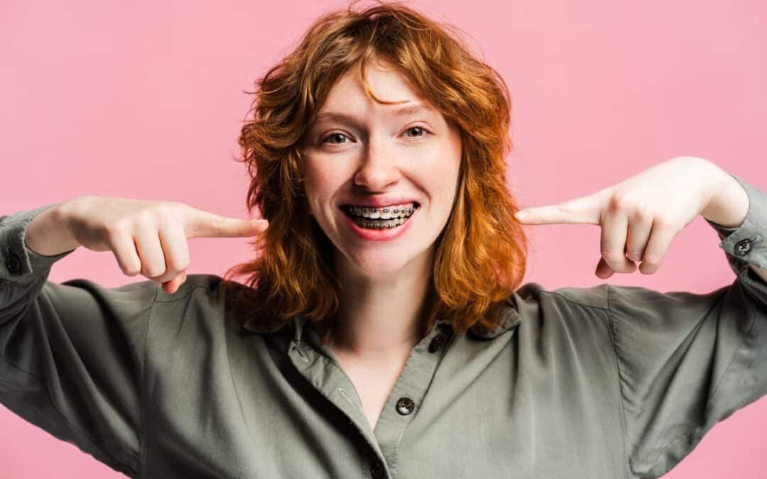 Do Your Braces Results Really Last Forever?