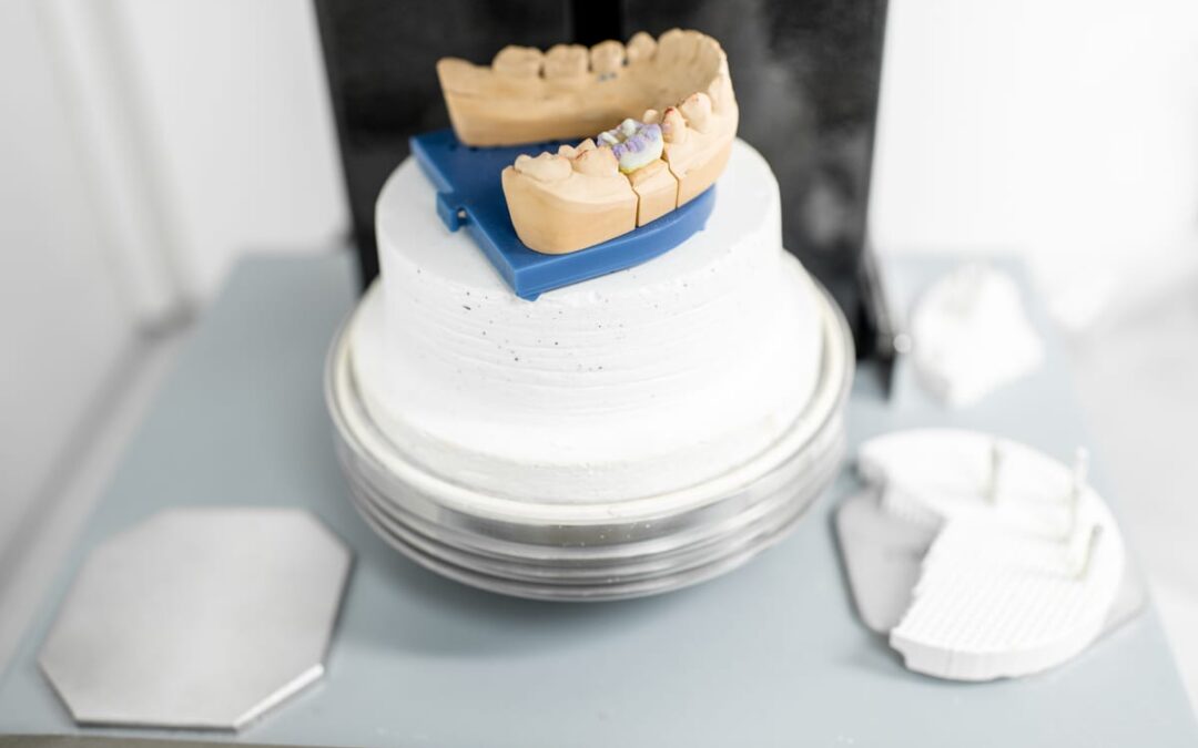 Dental Crowns in Imperial
